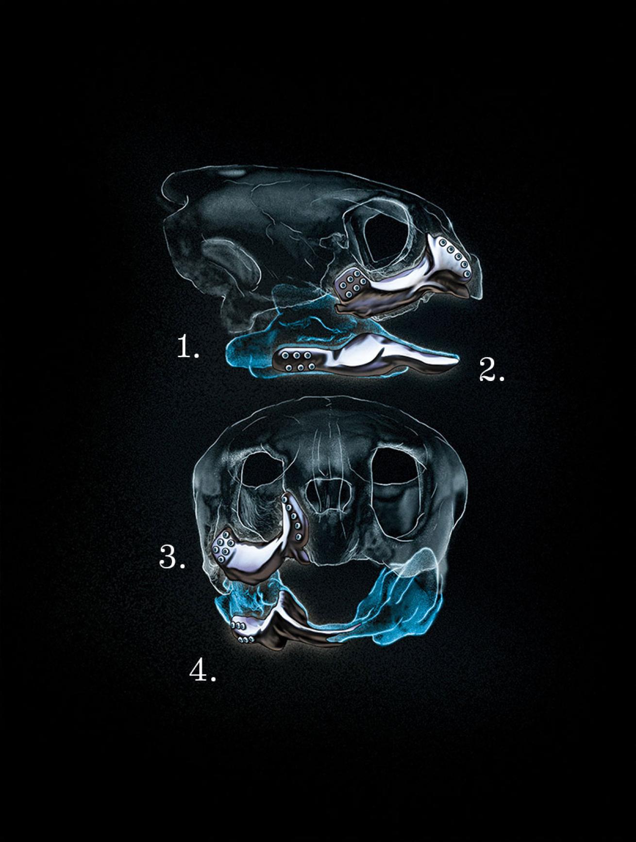 Illustration of Titanium Turtle Jaw Created with 3-D printer