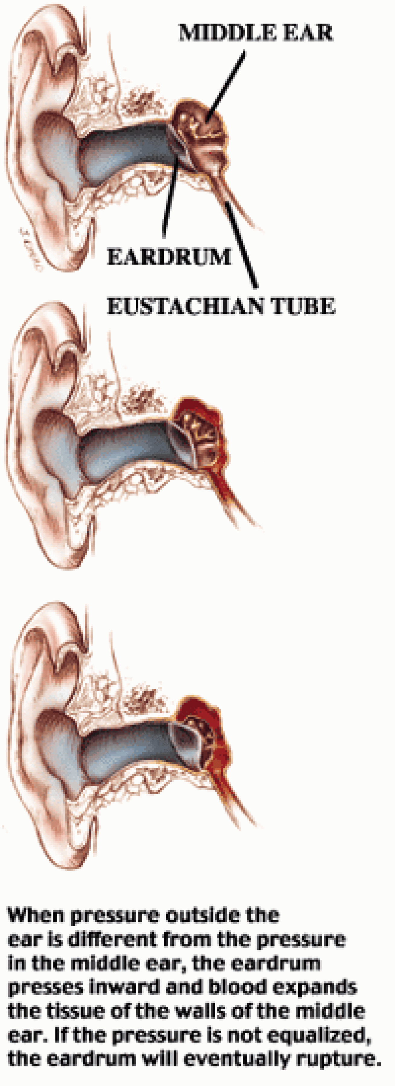 scuba diving ear pain